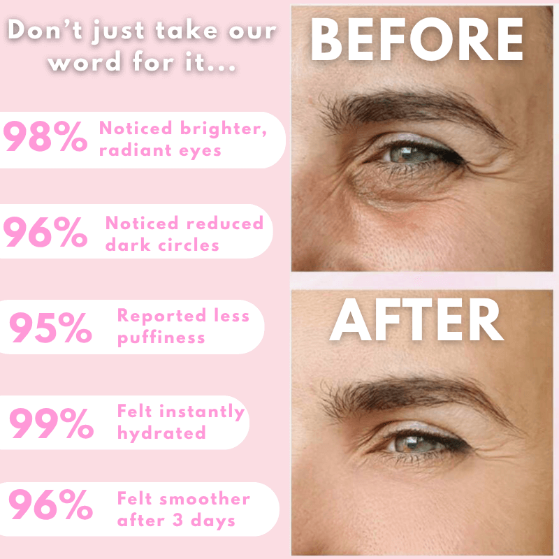 LunaLoft™ Collagen Glow Eye Masks