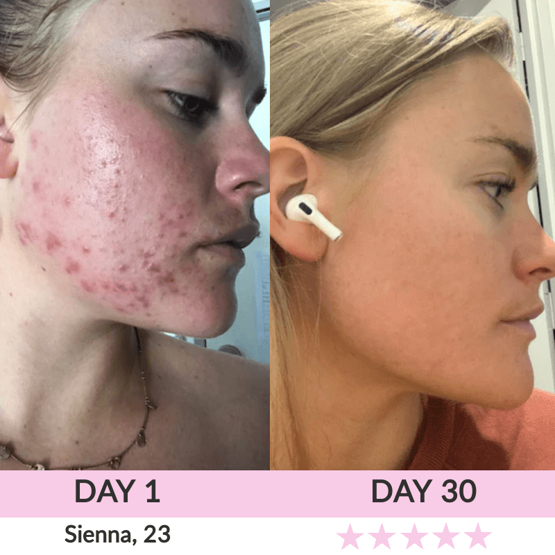 High Frequency Wand | LunaLoft™