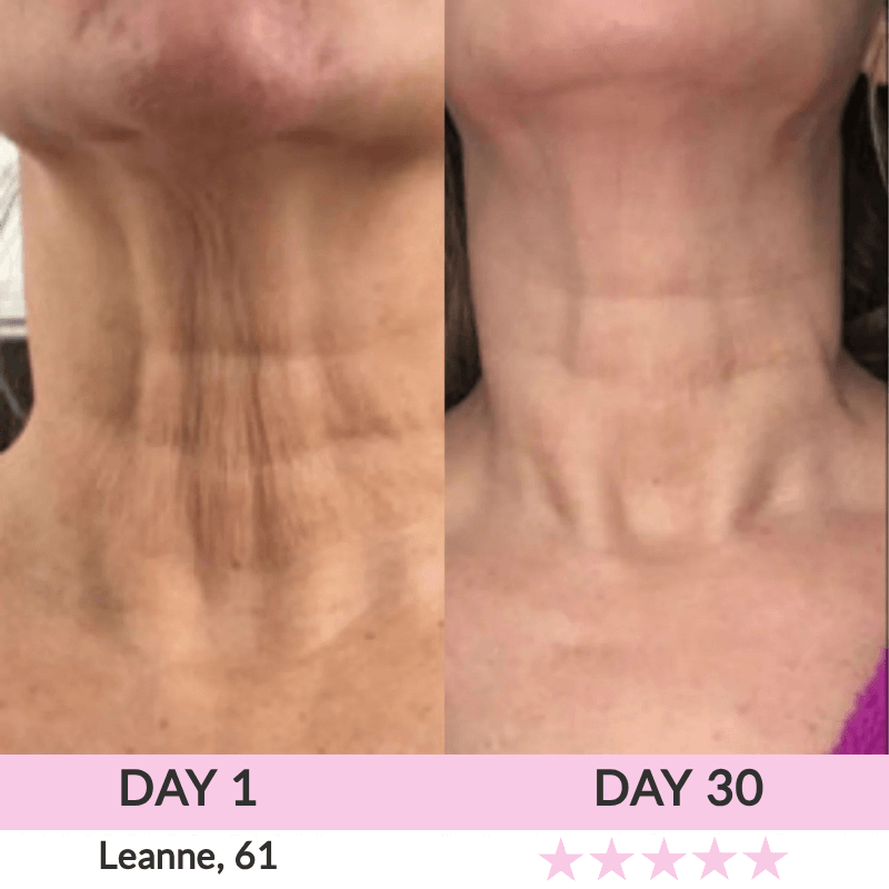LunaLoft™ 3-IN-1 Face & Neck Sculptor