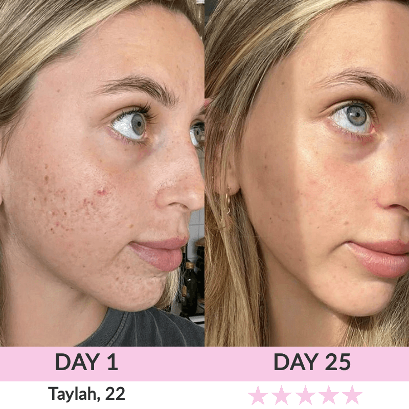 LunaLoft™ 3-IN-1 Face & Neck Sculptor
