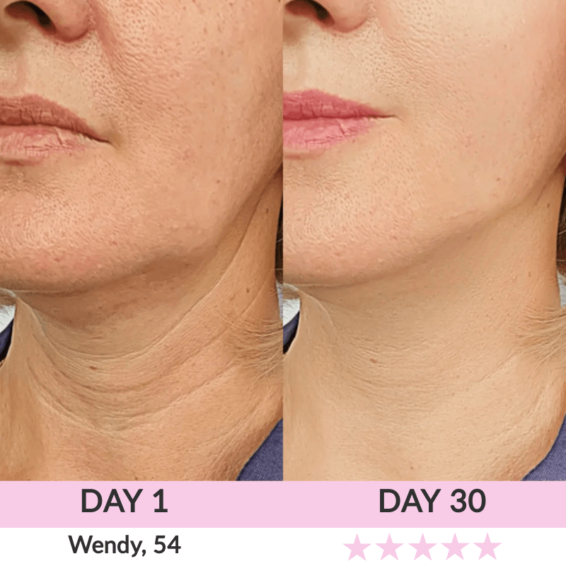 LunaLoft™ 3-IN-1 Face & Neck Sculptor