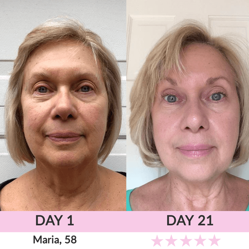 LunaLoft™ 3-IN-1 Face & Neck Sculptor