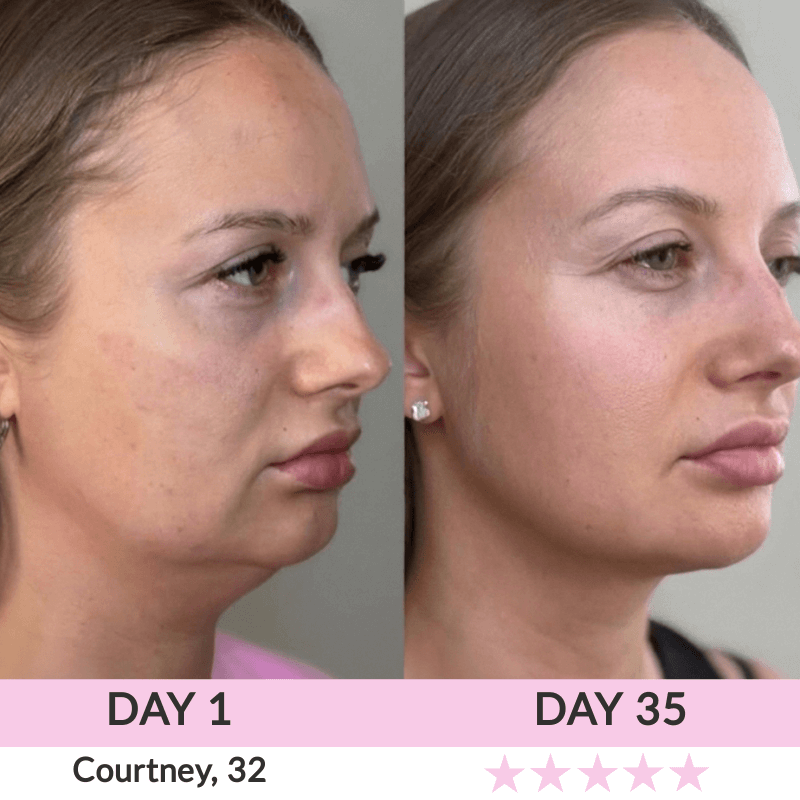 LunaLoft™ 3-IN-1 Face & Neck Sculptor