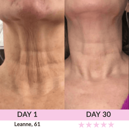 LunaLoft™ 3-IN-1 Face & Neck Sculptor