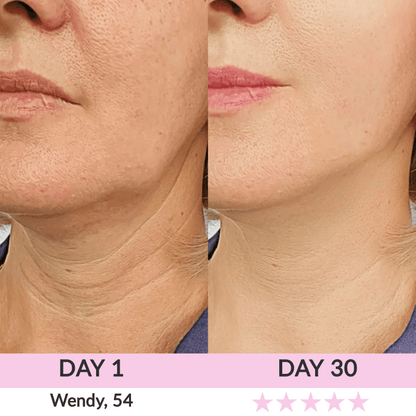 LunaLoft™ 3-IN-1 Face & Neck Sculptor