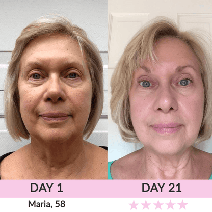 LunaLoft™ 3-IN-1 Face & Neck Sculptor