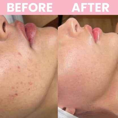 LunaLoft™ Collagen Overnight Glow Mask
